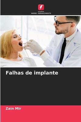 Falhas de implante by Zain Mir Paperback Book