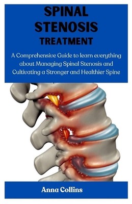 Spinal Stenosis Treatment: A Comprehensive Guide to learn everything about Manag