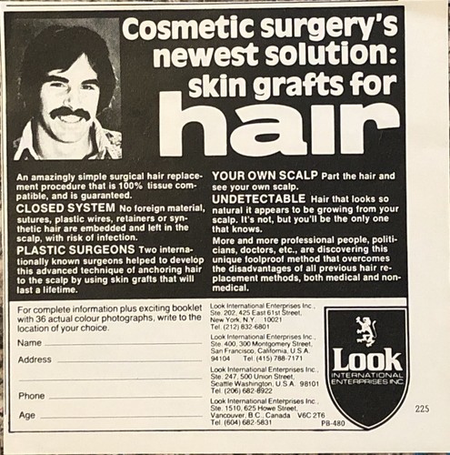 1980 Look International Hair Grafts VTG 80s PRINT AD