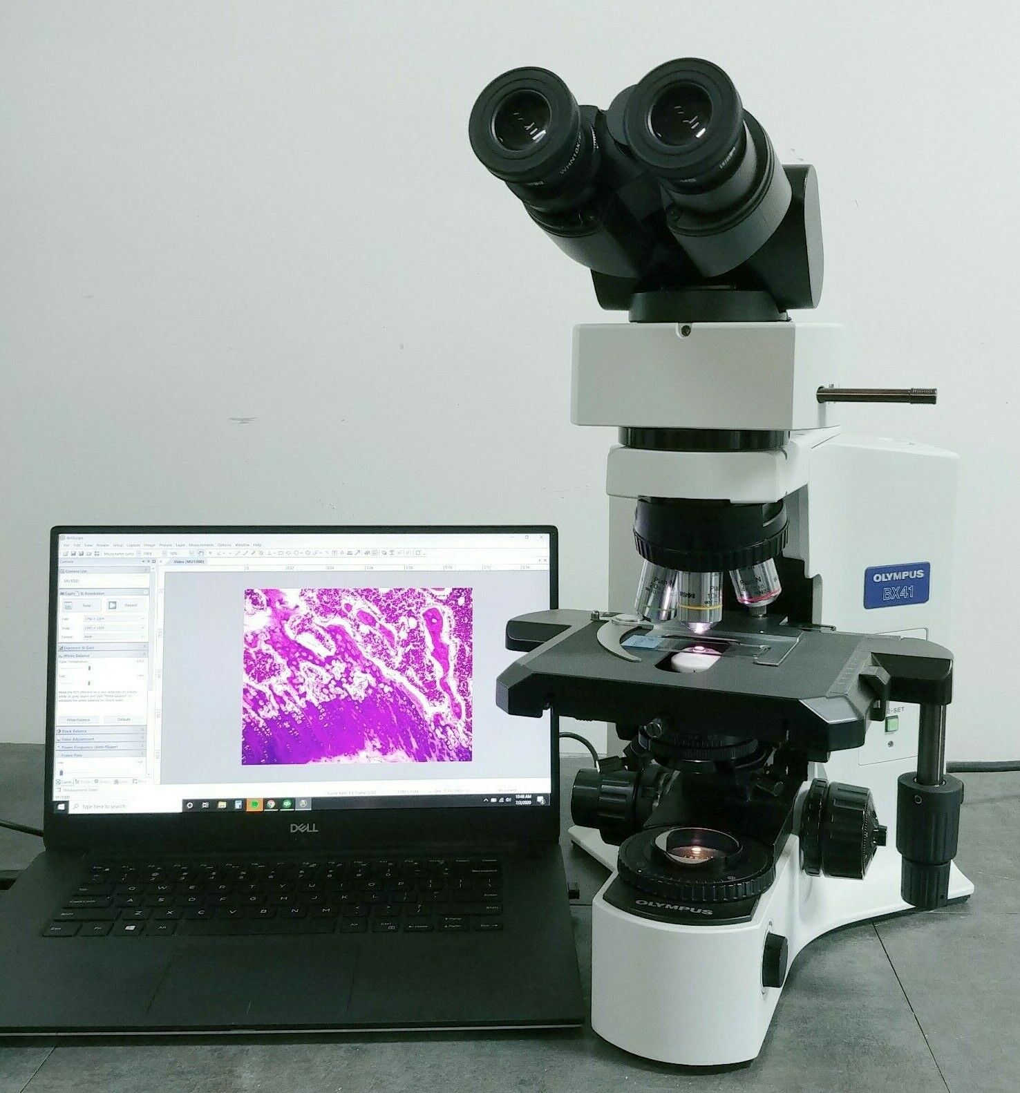 Olympus Microscope BX41 with 2x Objective and 10 MP Camera Olympus Microscope BX41 with 2x Objective and 10 MP Camera
