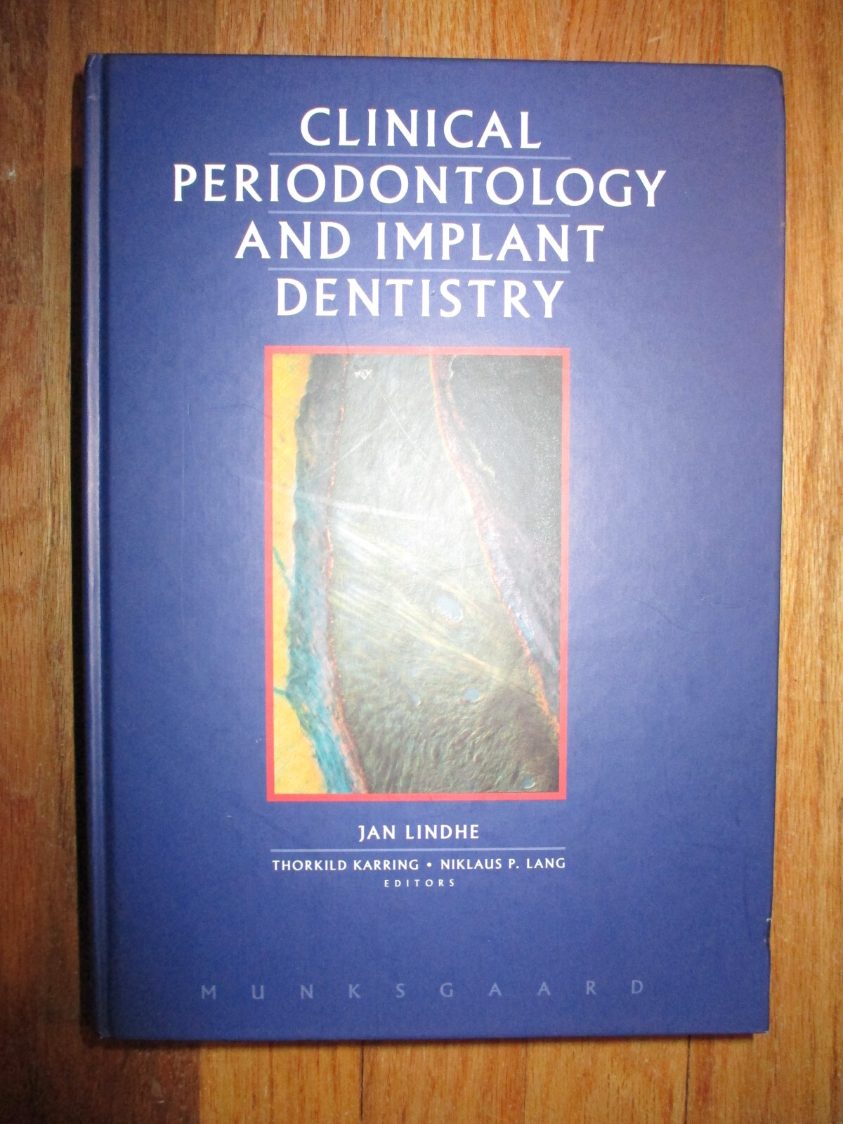 Clinical Periodontology and Implant Dentistry Jan Lindhe HC