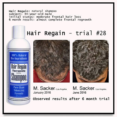 Hair regrowth shampoos deals