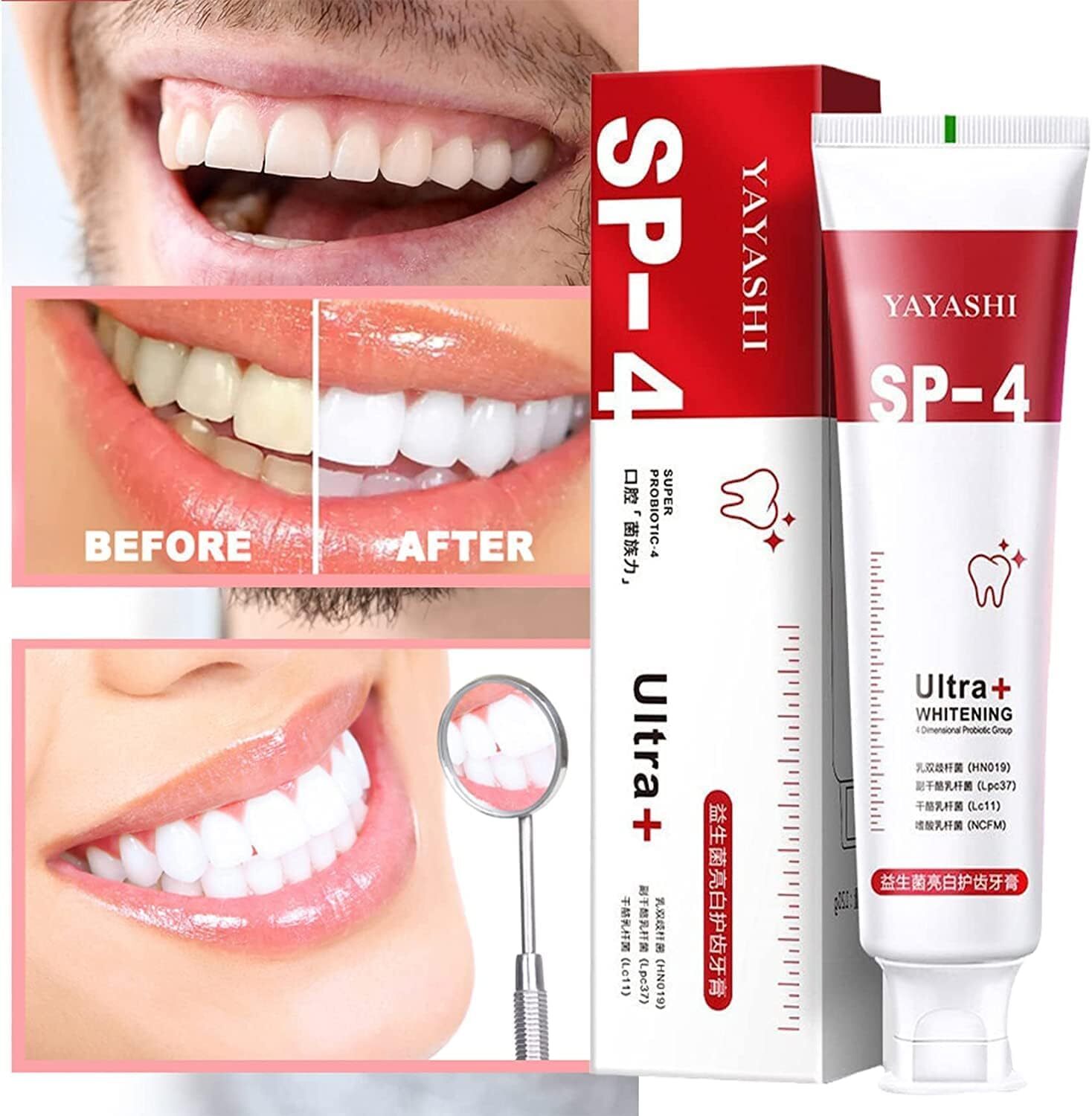 Sip 4 зубная. Sip 4 зубная