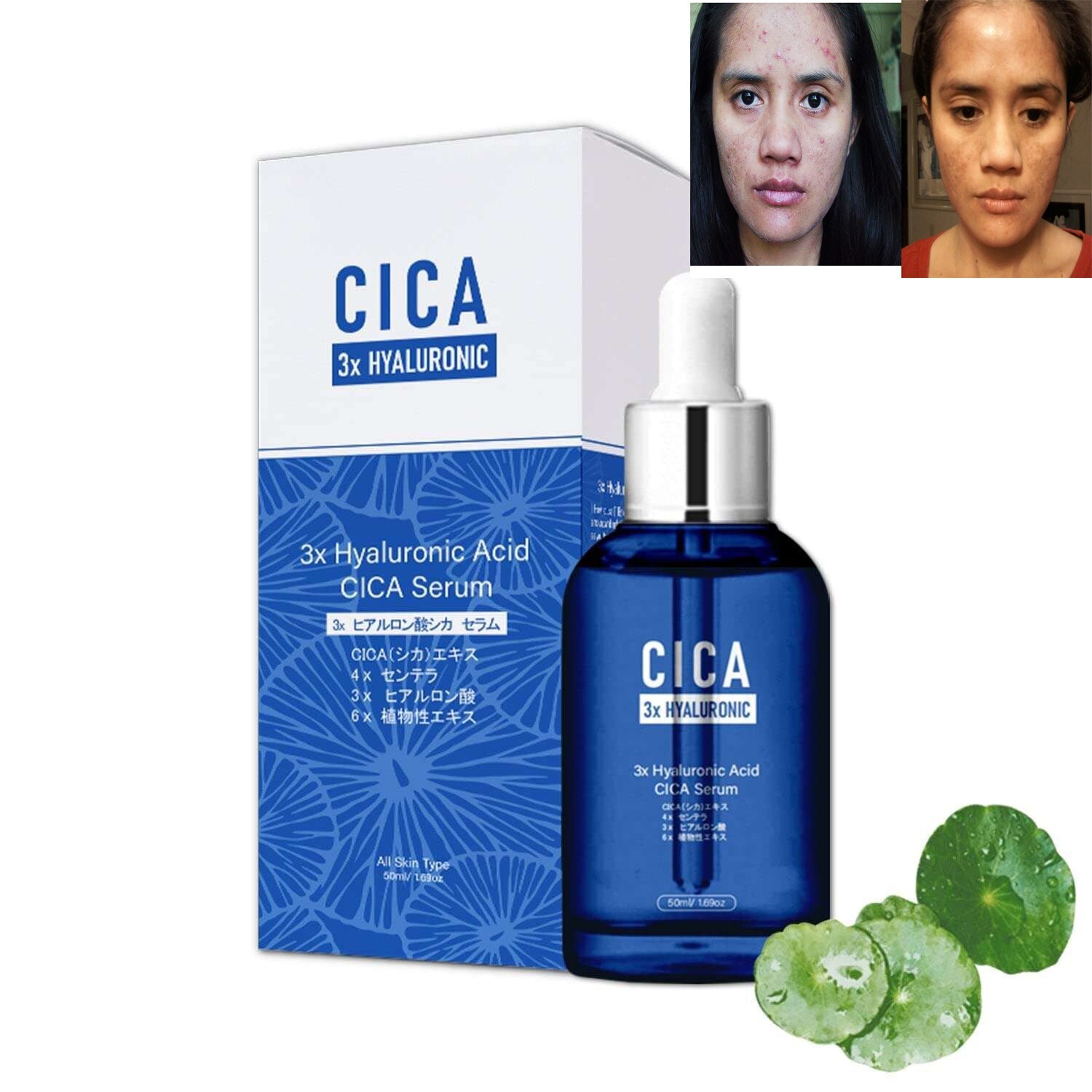 Re:NEEDLE SERUM CICA美容液 Re:NEEDLE SERUM CICA美容液
