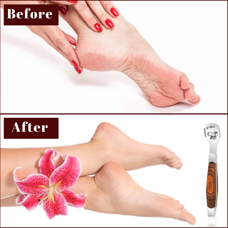 Callus Shaver, Foot Shaver Callus Remover for Feet Hand Care with Foot File, 10P