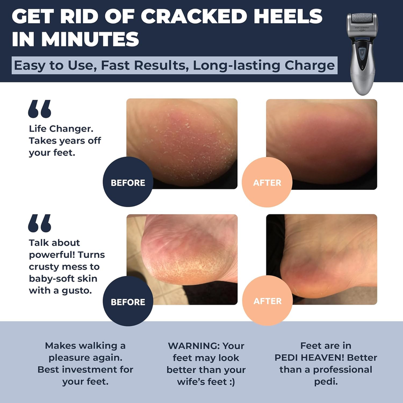 Callus Remover: Electric Rechargeable Pedicure Tools for Men/Women by  w 3 Rolle