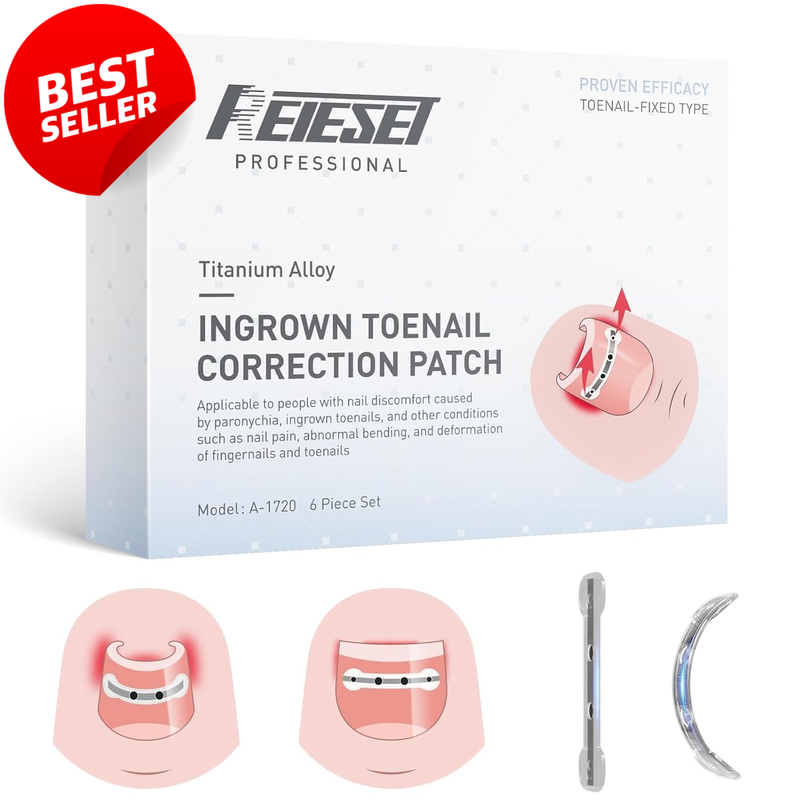 Titanium Alloy Ingrown Toenail Removal Kit Curved Nail Repair Tools - US