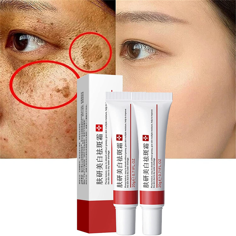 2 Pcs Whitening Cream For Dark Spots ELIMINATES Freckles And Skin Dark Spots