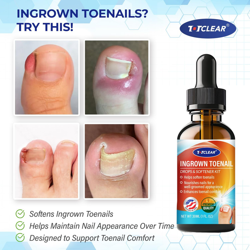 Ingrown Toenail Drops: Ingrown Toenail Tool for Men Women - Big Toe Ingrown Nail