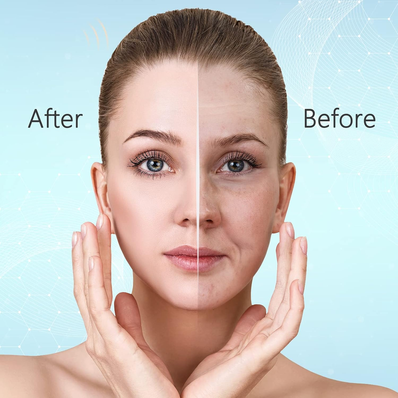 High Frequency Facial Light Therapy Wand Machine with Neon Tubes for Face Chin N