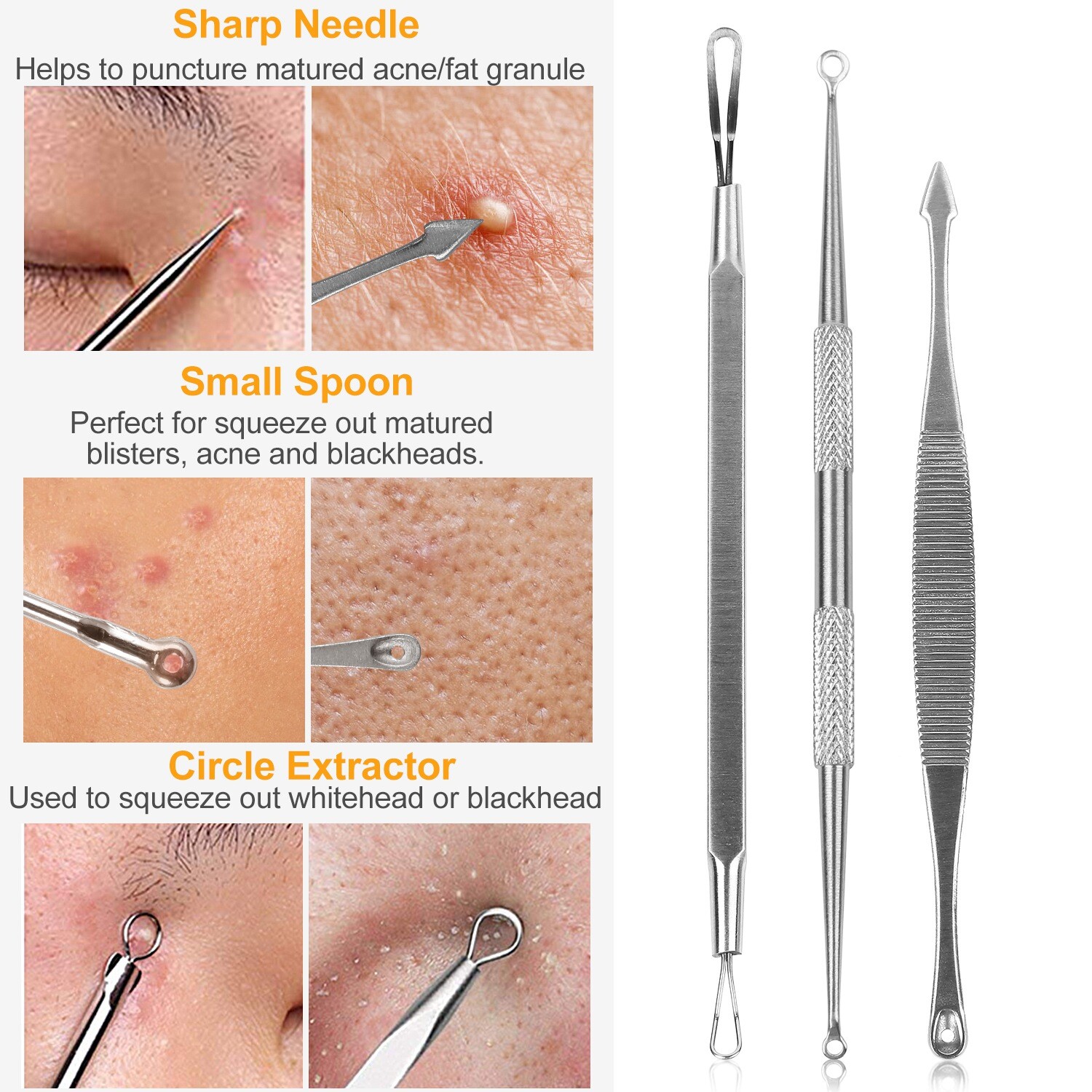 5pcs Blackhead Acne Comedone Pimple Blemish Extractor Remover Stainless