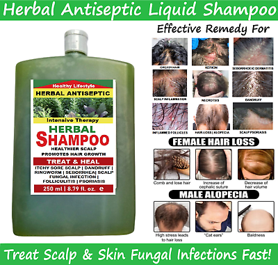 SCALP PSORIASIS ECZEMA Relief Organic HERBAL Shampoo Remedy for Itchy Scalp