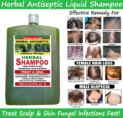 Scalp folliculitis shampoo deals