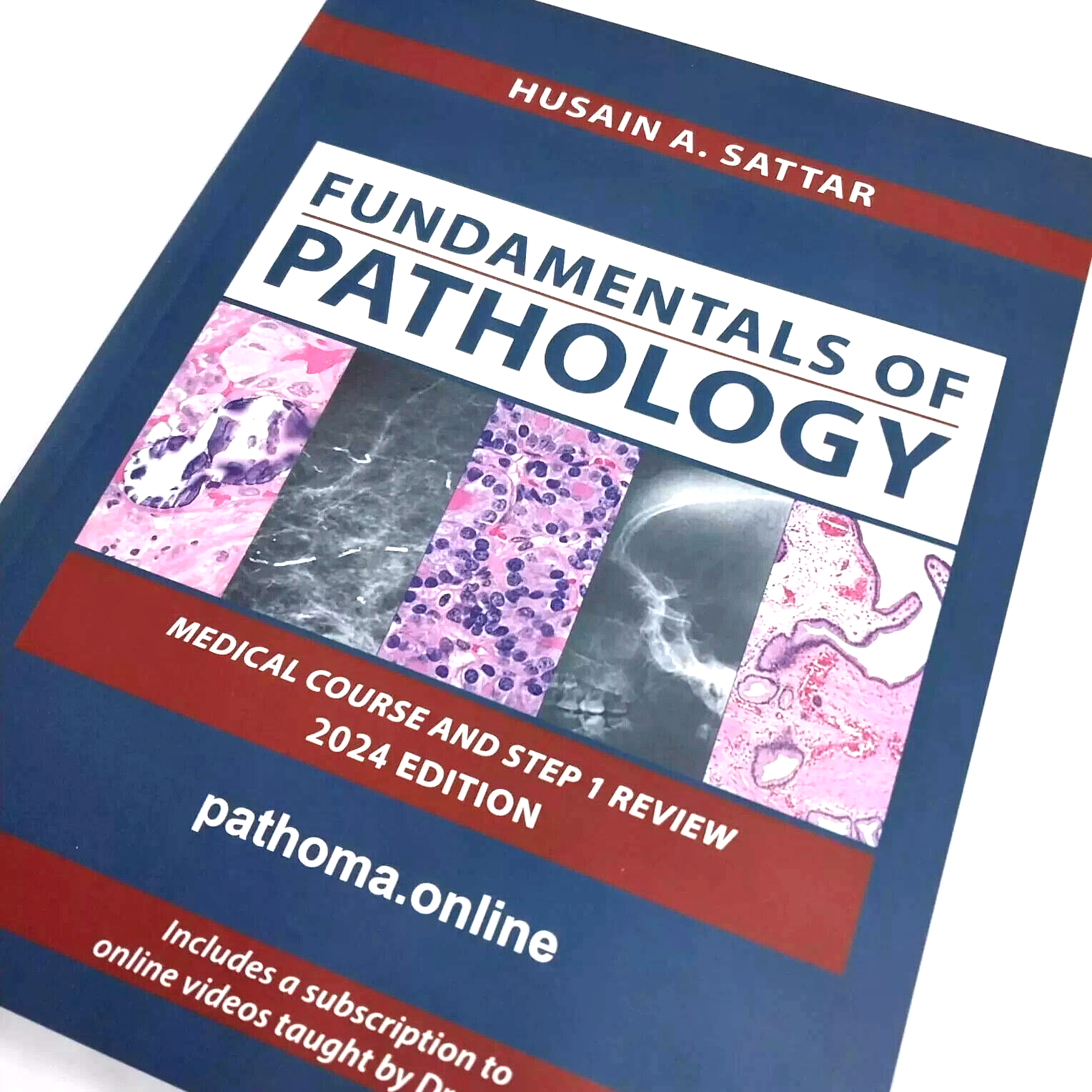 病理学 PATHOMA: Pathology USMLE STEP REVIEW $_57.PNG?set_id=880000500F