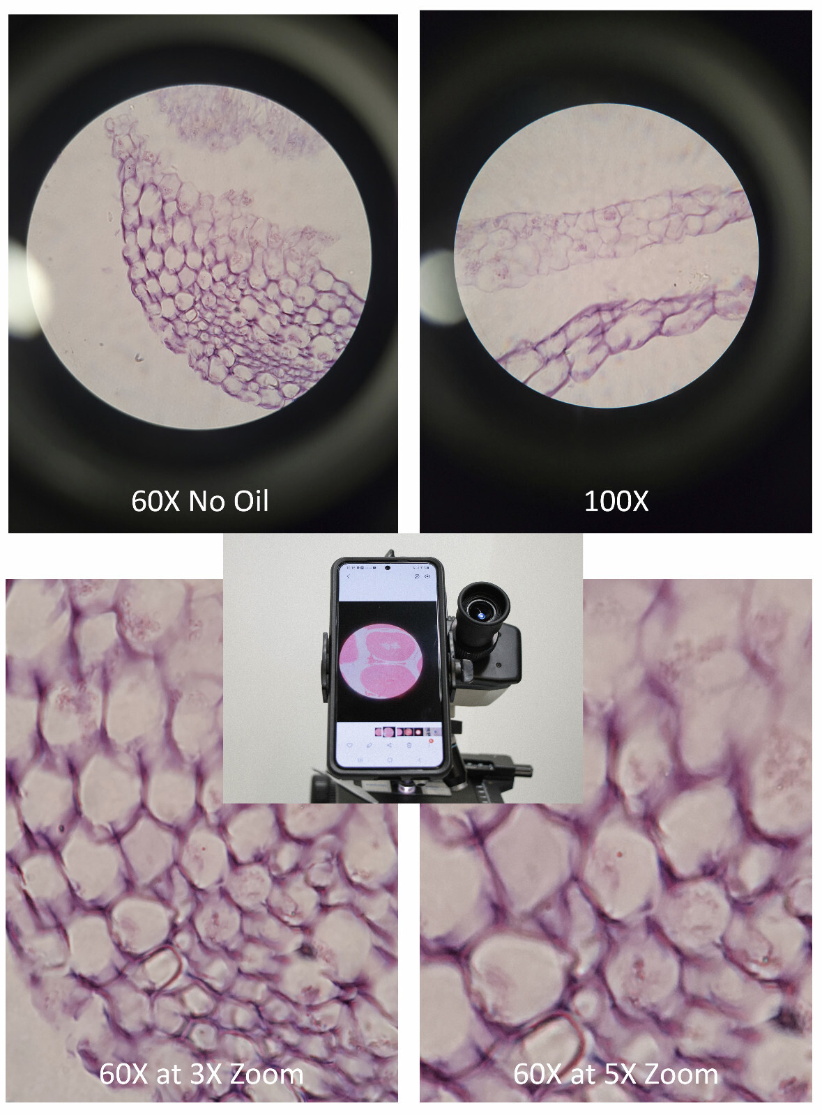 Sturdy Microscope Eyepiece Camera Adapter for Smartphone & iPhone