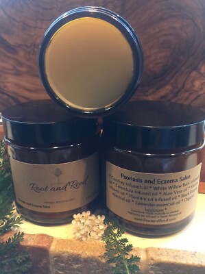 Psoriasis and Eczema Salve - All Natural -