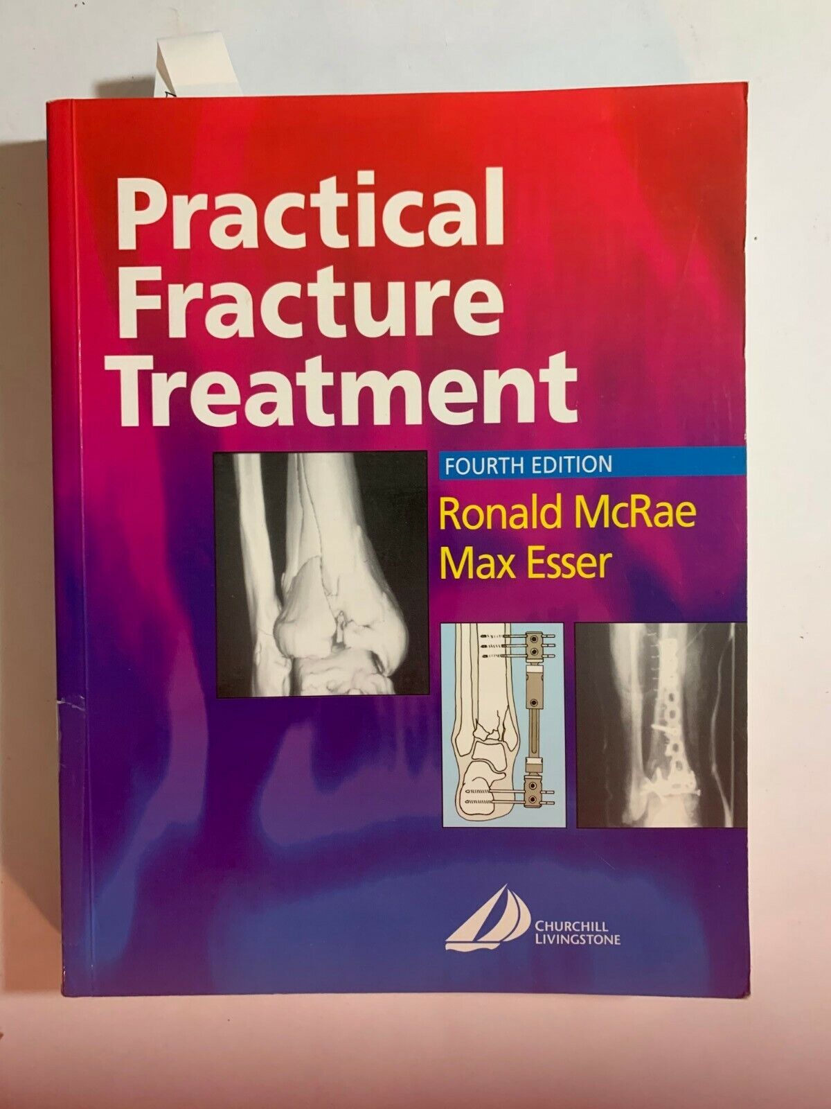 Practical Fracture Treatment, 4th Edition Ronald McRae and Practical Fracture Treatment, 4th Edition Ronald McRae and
