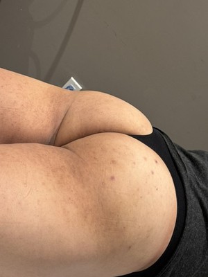 Objectfoto('s) van geverifieerde koper