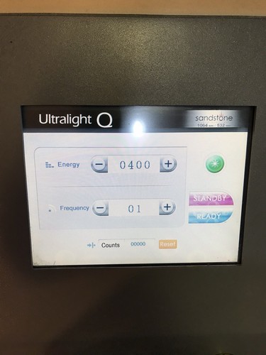 laser tattoo removal machine