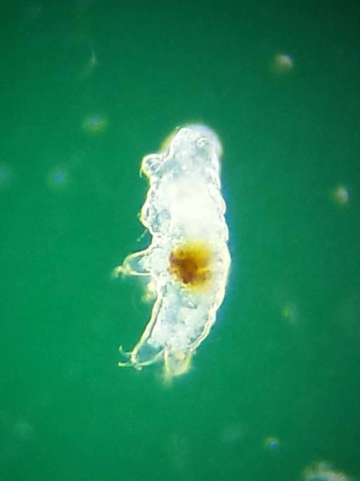 Microscope 32mm Rheinberg Filters Set With Darkfield Lighting - Marvelous Set!!!