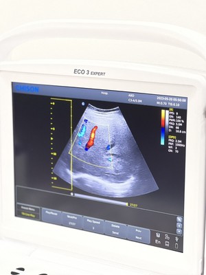 ECO3 Expert Doppler Color