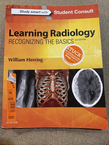 Learning Radiology: Recognizing the Basics [ペーパーバック] Herring MD  FACR，William Learning Radiology : Recognizing the Basics by William