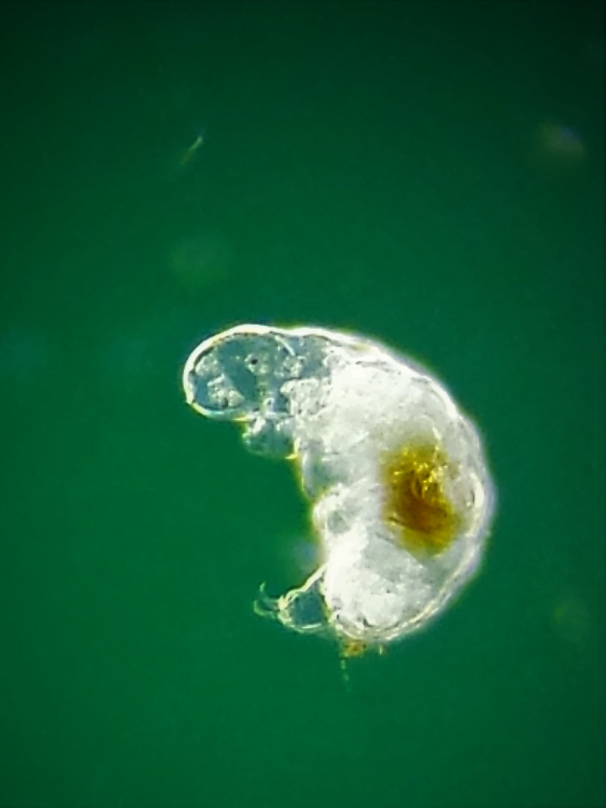 Microscope 32mm Rheinberg Filters Set With Darkfield Lighting - Marvelous Set!!!