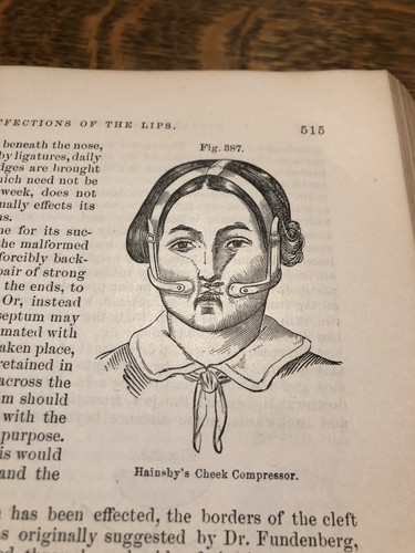 Antique Medical Books, System Of Surgery Gross Vol 1&2 1872 -Orig Leather W/ Adv