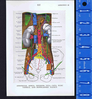 Abdominal Aorta, Inferior Vena Cava, Plexus & More- 1947 Medical Anatomy Prints 