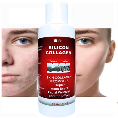 Acne Scars Silicon Collagen Gel Facial Skin Resurfacing Wrinkle Blemish ALKAVITA