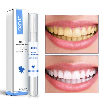 Tooth Whitening Gel Pen Extra Strong Stain Removal White Hygiene  Whitener