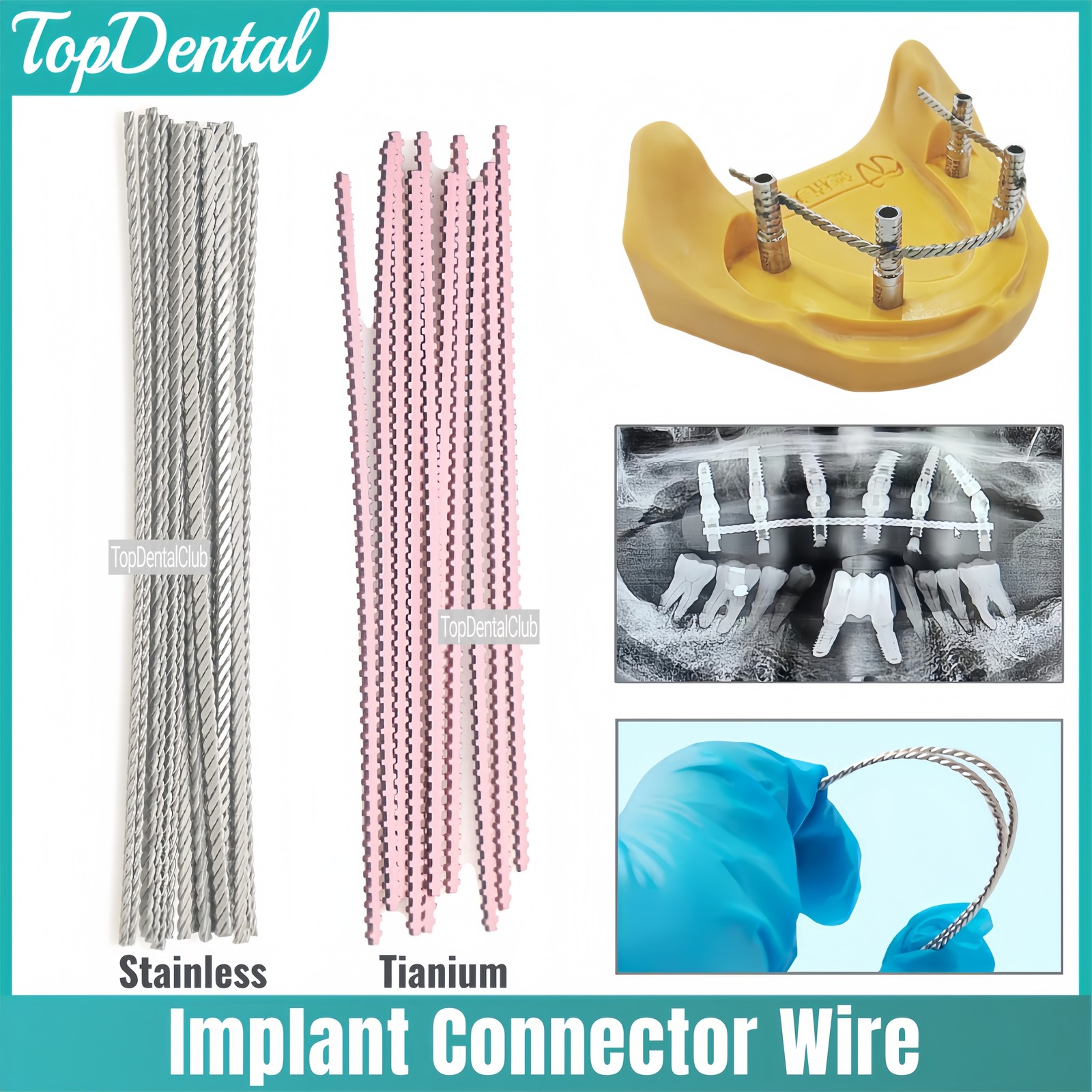 Dental Connector Stainless Tianium Strengthener Twist Wire