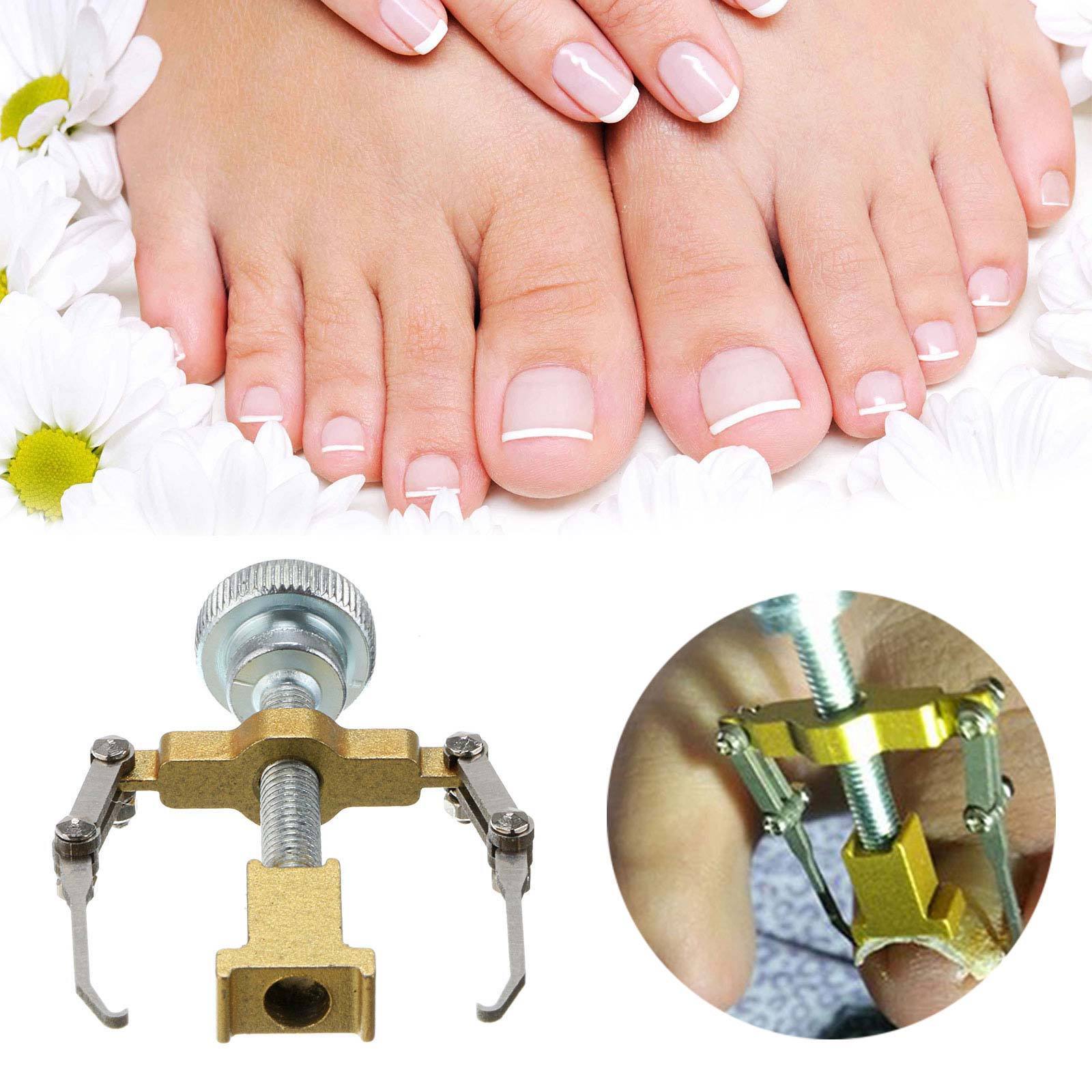 Ingrown Toenail Manicure Pedicure Foot Care Correction Brace Tool Toe