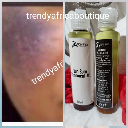 SUN BURN TREATMENT OIL. 100ML X 1. For ALL SKIN TYPES