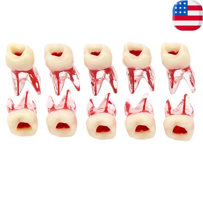 Dental RCT/MTA Molar 36# Endo Root Canal Study Model Practice Block Pulp Cavity