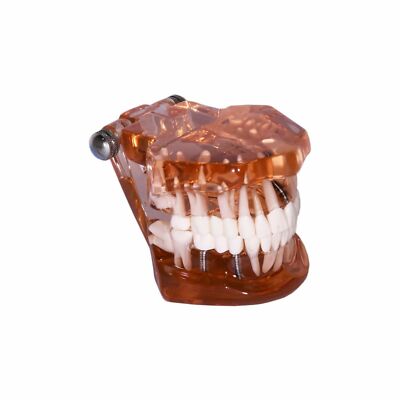 Redland B5-05 Dental Demonstration Teeth Educational Model -FDA