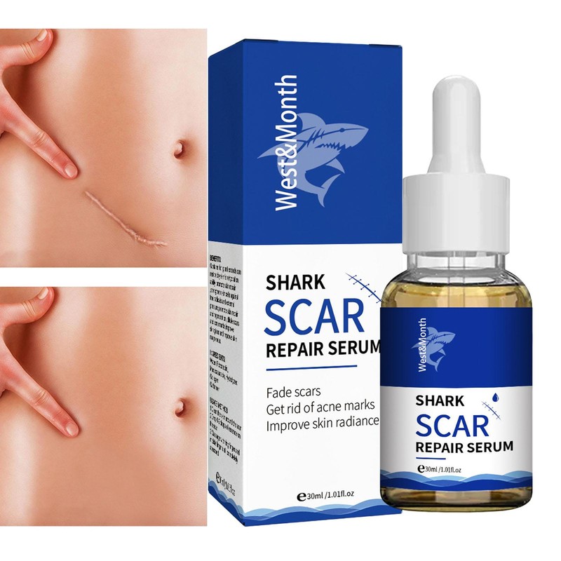Scar Acne Removal Skin Care Stretch Marks Lighten Old Scars Burns Repair Essence