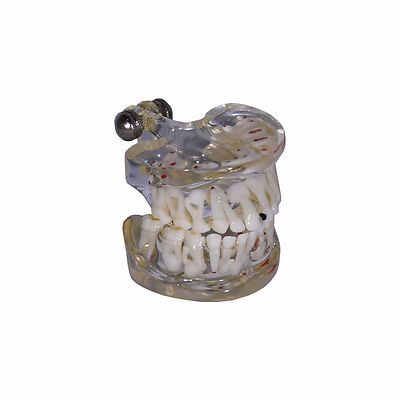 REDLAND Dental Demonstration Teeth Educational Model -1089 Model 6