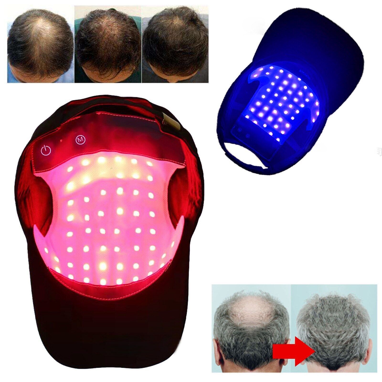 650nm Red Light Therapy Hair Loss Treatment Laser Cap Growth Regrowth Helmet US