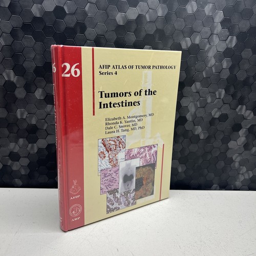 語学+参考書 Tumors of the Intestines (AFIP Atlas of Tumor Pathology Series 4) Amazon | Tumors of the Intestines (AFIP Atlas of Tumor