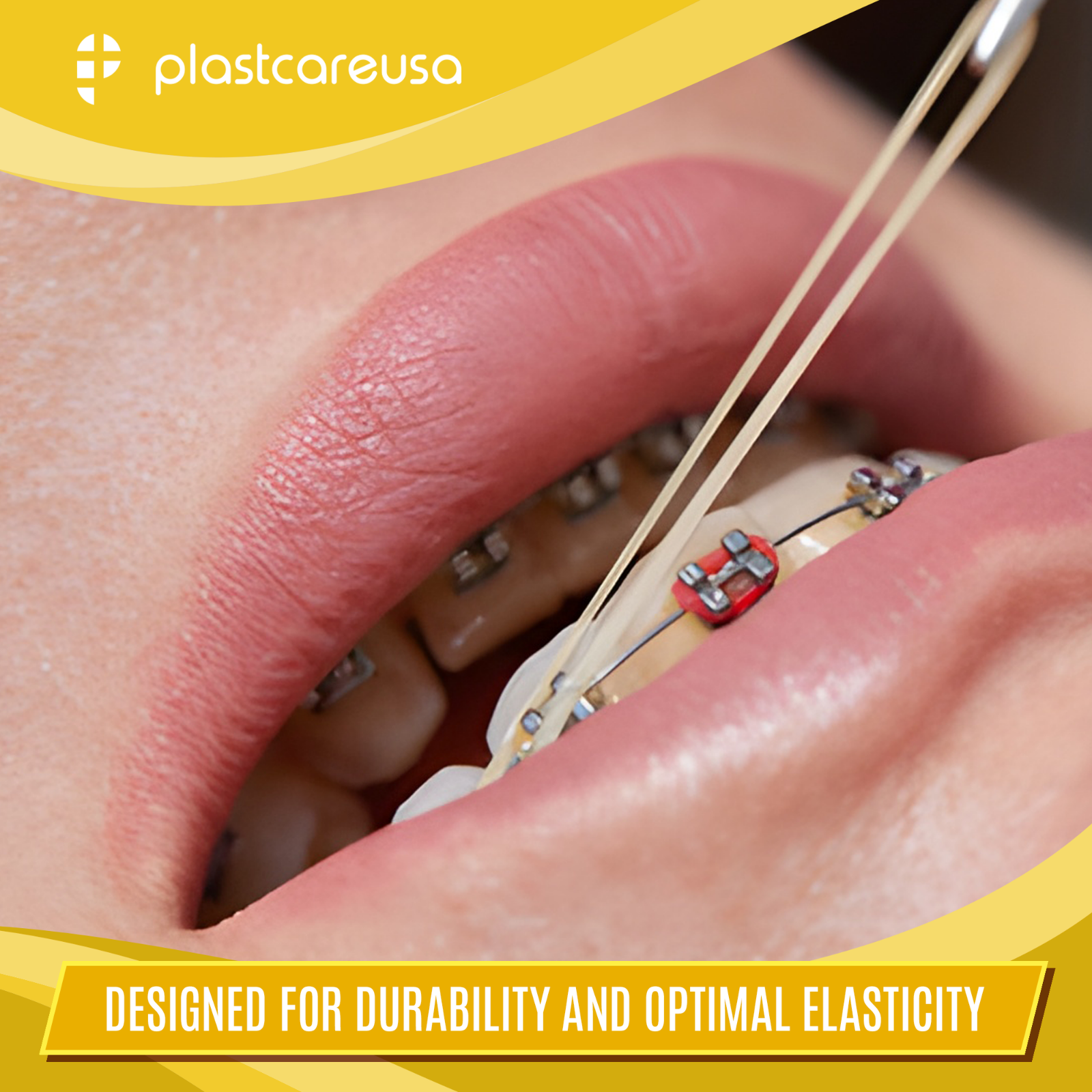 Latex Elastics Rubber Bands Orthodontic Dental Braces Teeth - Light Medium Heavy