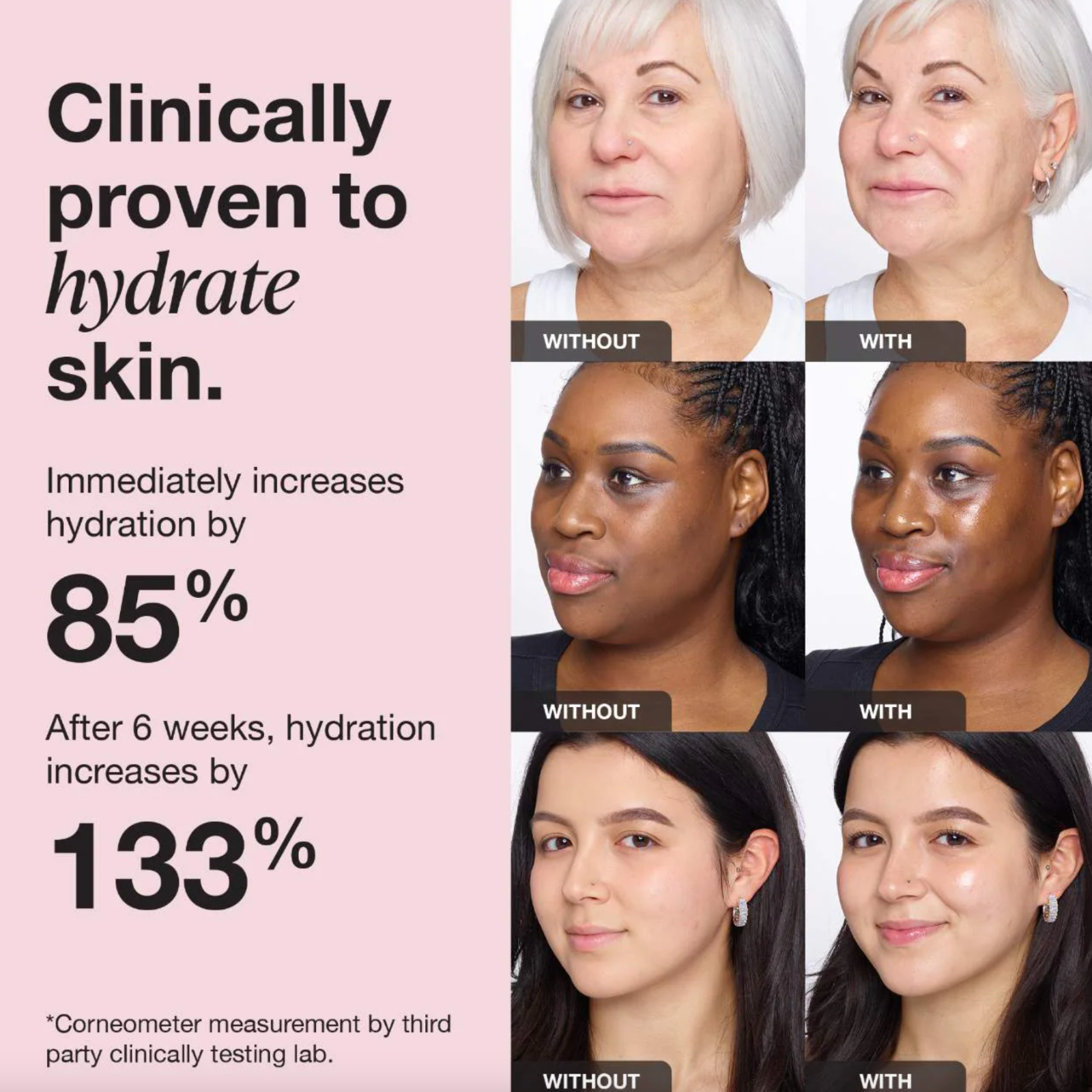 iNNBEAUTY PROJECT Extreme Cream Anti-Aging, Firming & Lifting Moisturizer 1.7 oz