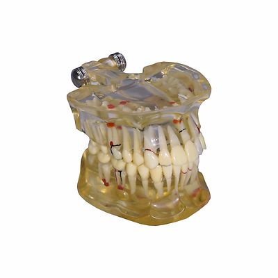 REDLAND Model Dental Demonstration Teeth Educational Model 