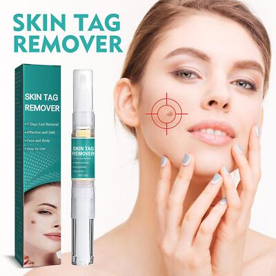 12 Hours Wart Remover Pen Skin Tag Mole Eliminate Foot Corn Warts Unisex Pack1-5