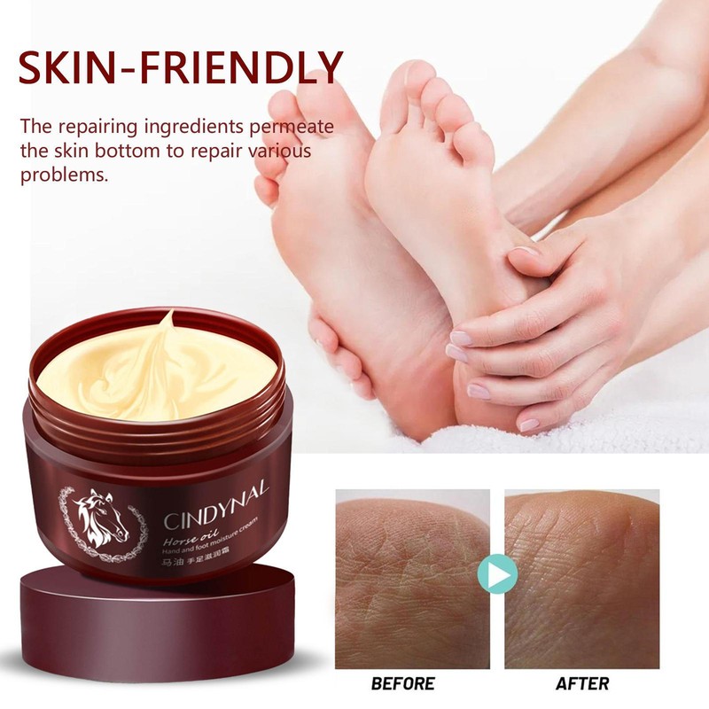 Hand And Foot Cream Anti-chapping Skin Repairing Moisturizer Balm