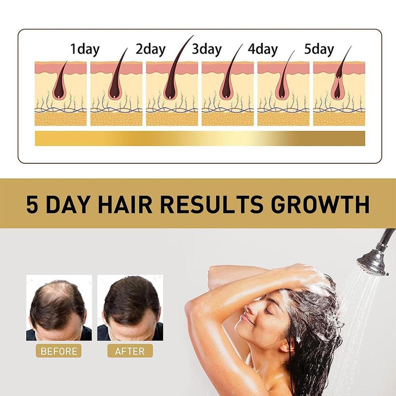 2PCS Sakura Japanese Shampoo, Sakura Hair Growth Japan'S No. 1 Shampoo