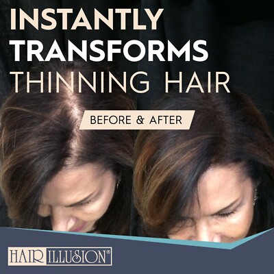 Hair Illusion KERATIN Hair Fibers For Bald Spot Concealer, Hairline, Hair Loss