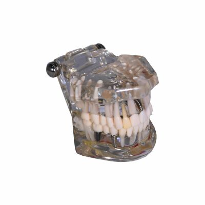 Redland Dental Demonstration Teeth Educational Model And Sales - FDA