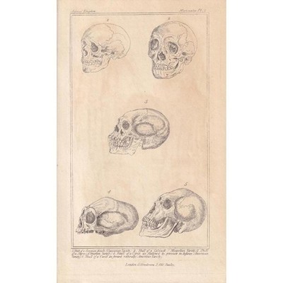 1834 HUMAN SKULLS Print - Hand-Coloured Antique - Anatomy Art - 5.3 x 8.2 Inches