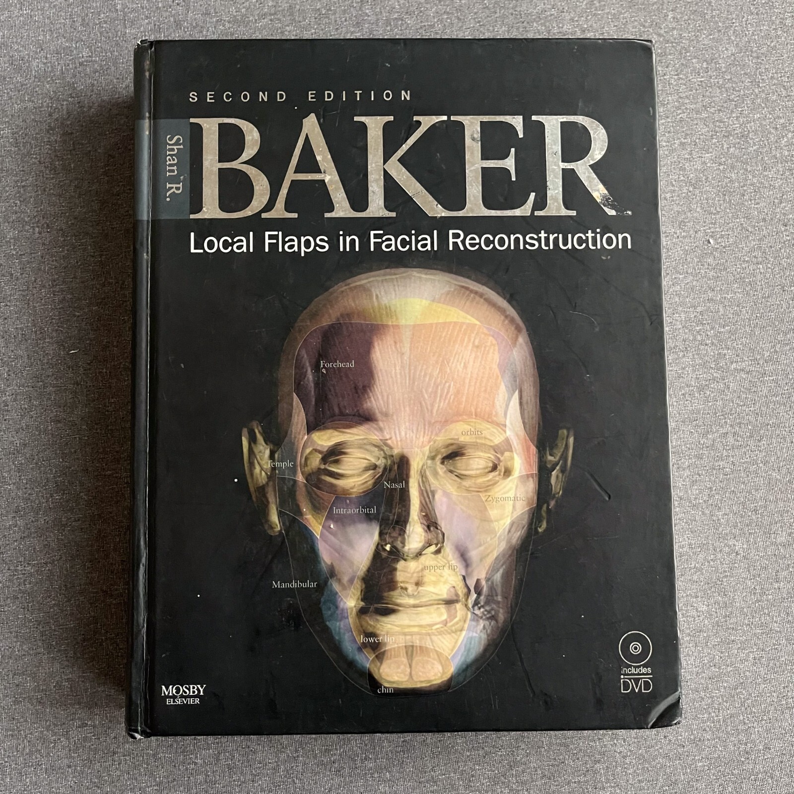 健康・医学 local flaps in facial reconstruction Shan R Baker - Local Flaps in Facial Reconstruction NO DVD